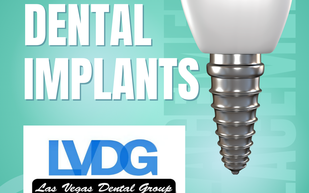 Dental Implants Las Vegas Implant Dentistry