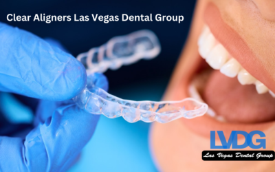 Invisalign Las Vegas Dental Group